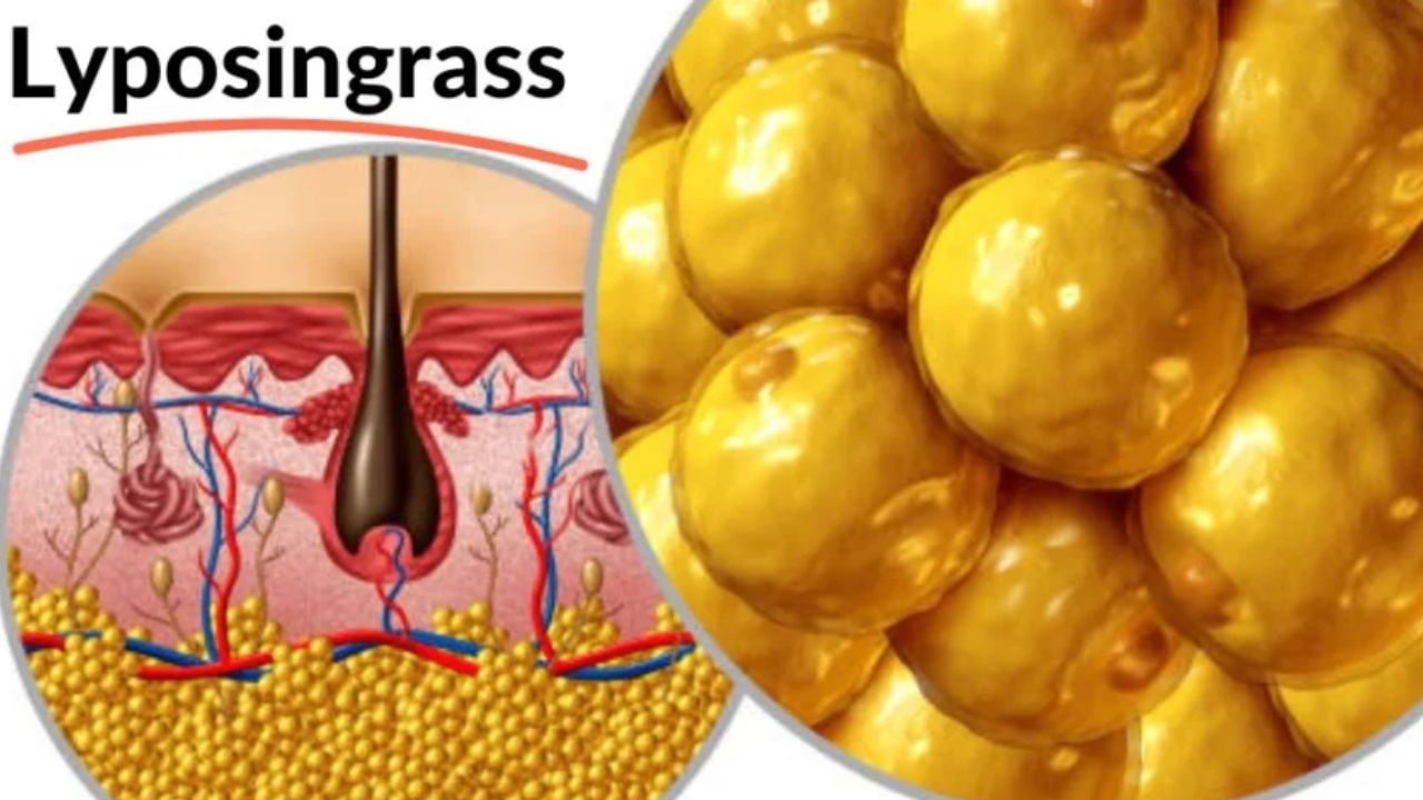 lyposingrass
